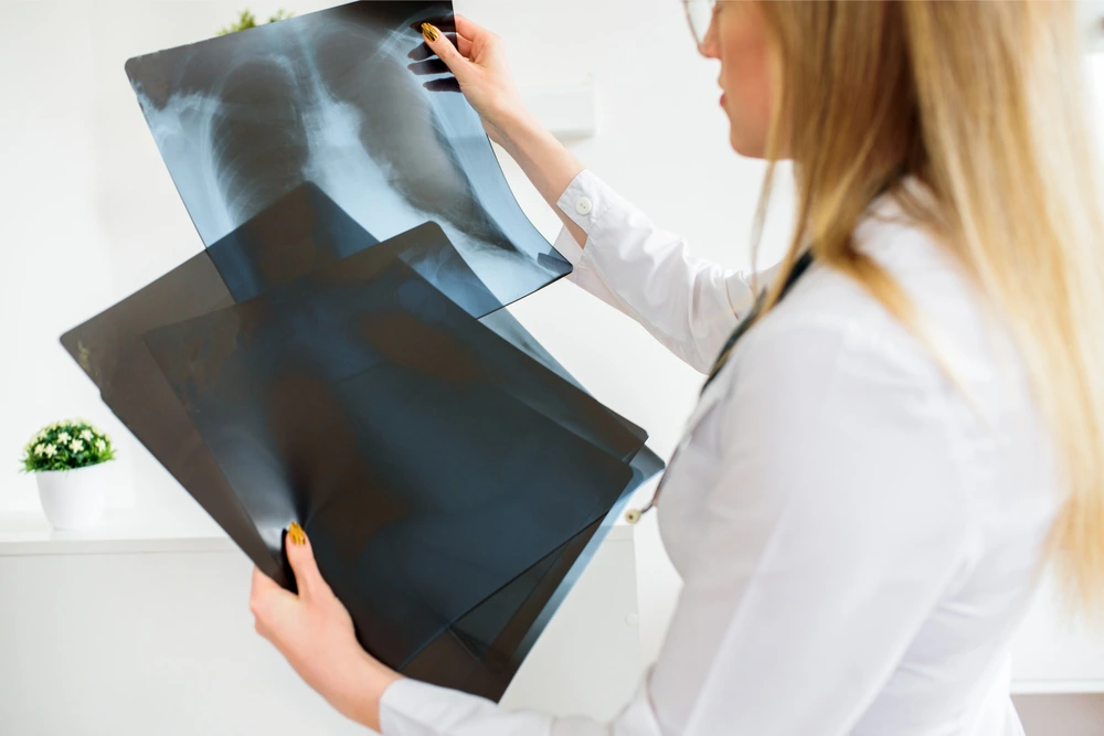 Doctor examining x-ray of pacemaker
